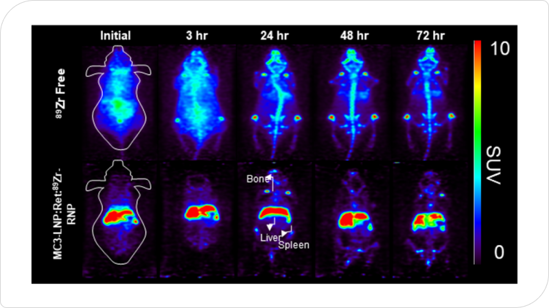 지르코늄-89(89Zr)와 합성한 크리스퍼 단백질이 간경화 질환을 가진 실험용 쥐에 투여되어 72시간동안 추적한 PET 영상자료다.